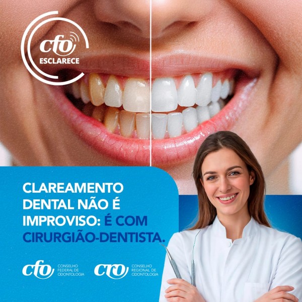 CFO Esclarece: antes do clareamento dental, saúde bucal deve estar em pleno equilíbrio